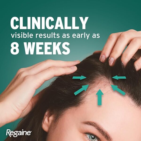 محلول ماینوکسیدیل 2% ریگین برای مردان و زنان Regaine 2% Minoxidil - Image 6
