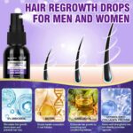 ماینوکسیدیل 5 نیگوادت | Nigwedete Minoxidil 5 اسپری رشد مو 5%