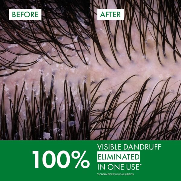 شامپو ضد شوره ویشی درکوس | Vichy Dercos Anti Dandruff برای مو نرمال تا چرب 200ml