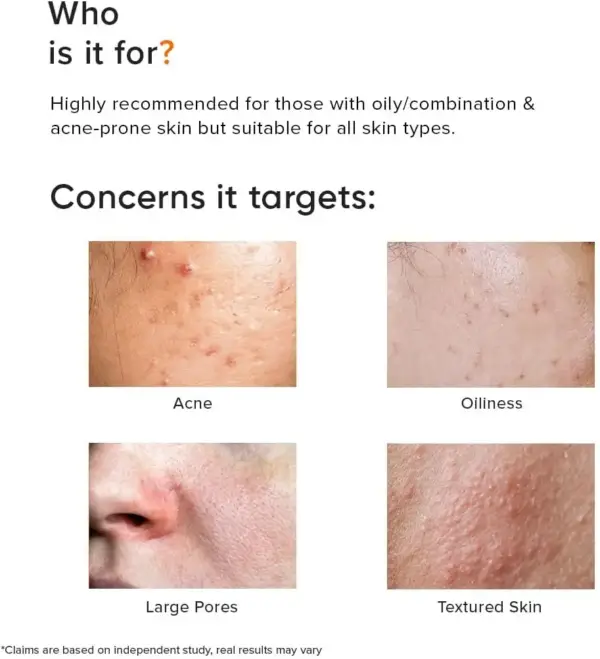 شوینده صورت مینیمال ضدجوش | Minimalist | سالیسیلیک اسید ۲٪ | 100ml