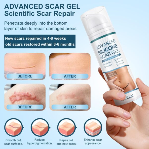 Mitgary ژل/کرم سیلیکونی درمان جای زخم و ترک پوست | Advanced Scar Cream 1.7 oz