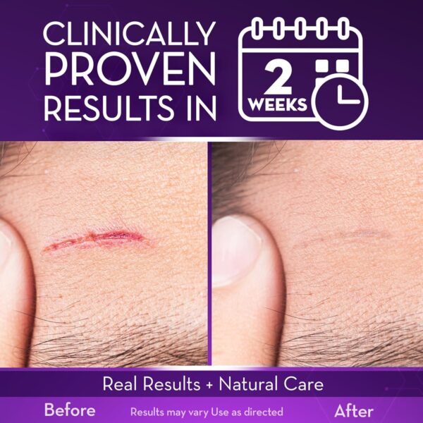 ژل اسکار سیکاتریکور | Cicatricure Face & Body Scar Gel