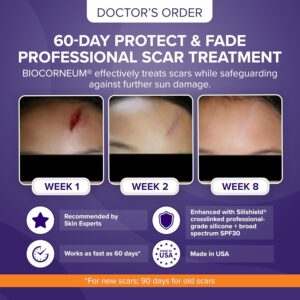 bioCorneum Plus SPF 30 | ژل مراقبت پیشرفته اسکار SPF 30 | 10 گرمی