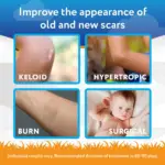 ژل جای زخم کودک اسکاراوی ۶ گرم | ScarAway Kids